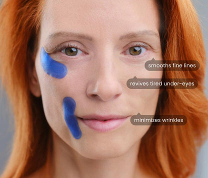 Avolo Micro-Infusion Targeted Patches